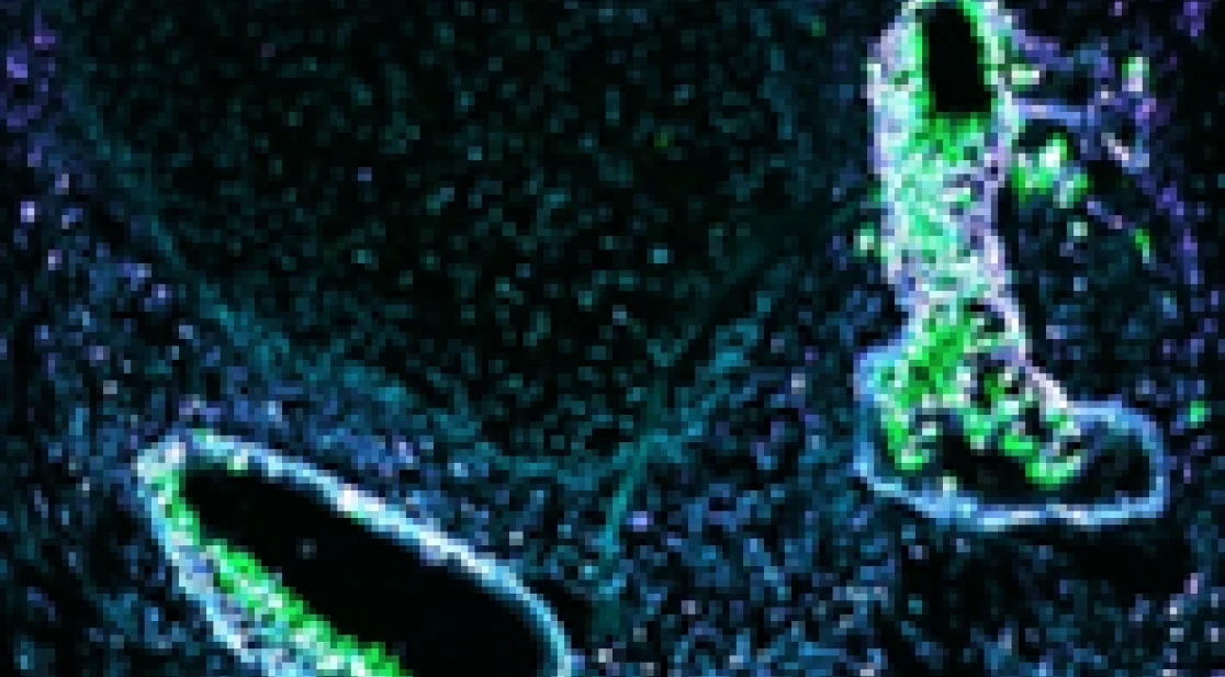 Floureszensmikroskopische Aufnahme eines Organoids