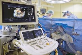 Bild eines 3D Echokardiographens