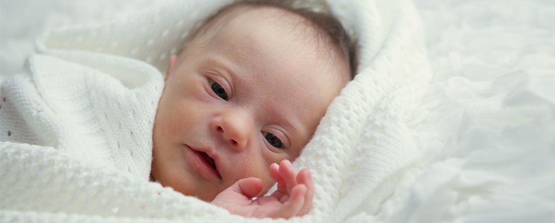 Baby mit Down-Syndrom