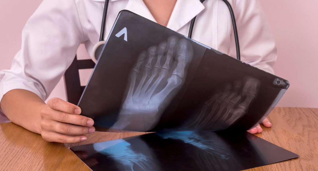 Röntgenbild von Füßen
