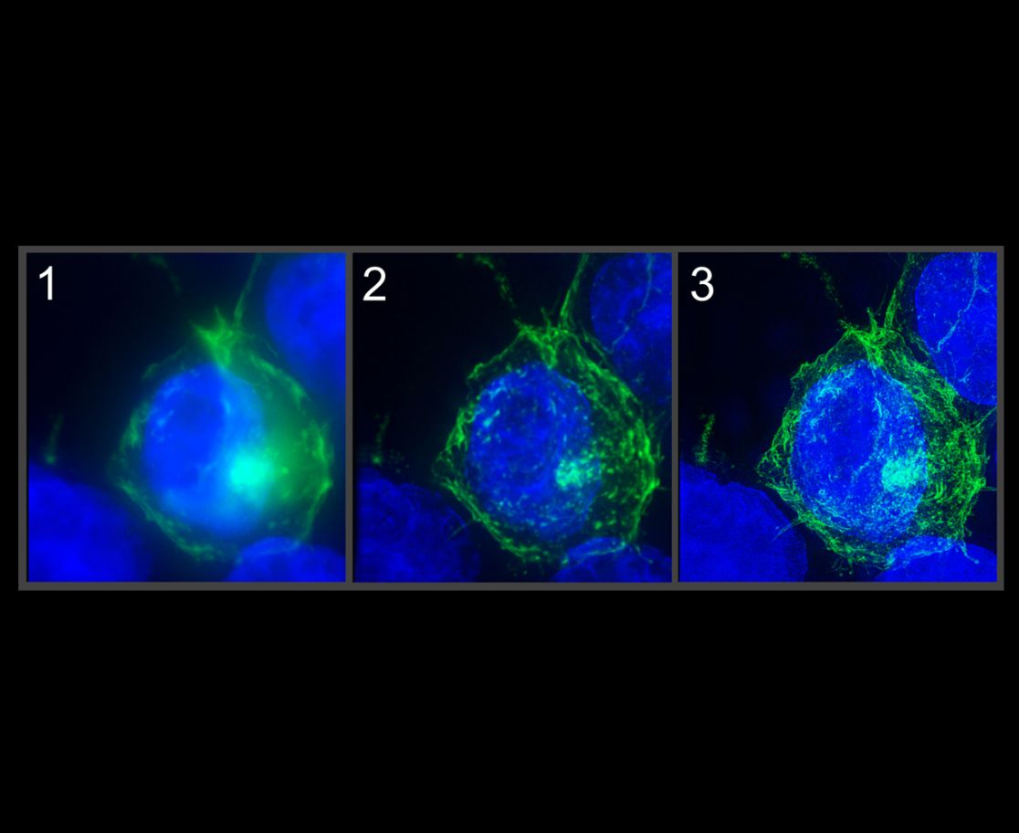 (1) Wide-field, (2) confocal and (3) 3D-SIM microscopy of HIV-1 Nef-expressing 293T cells