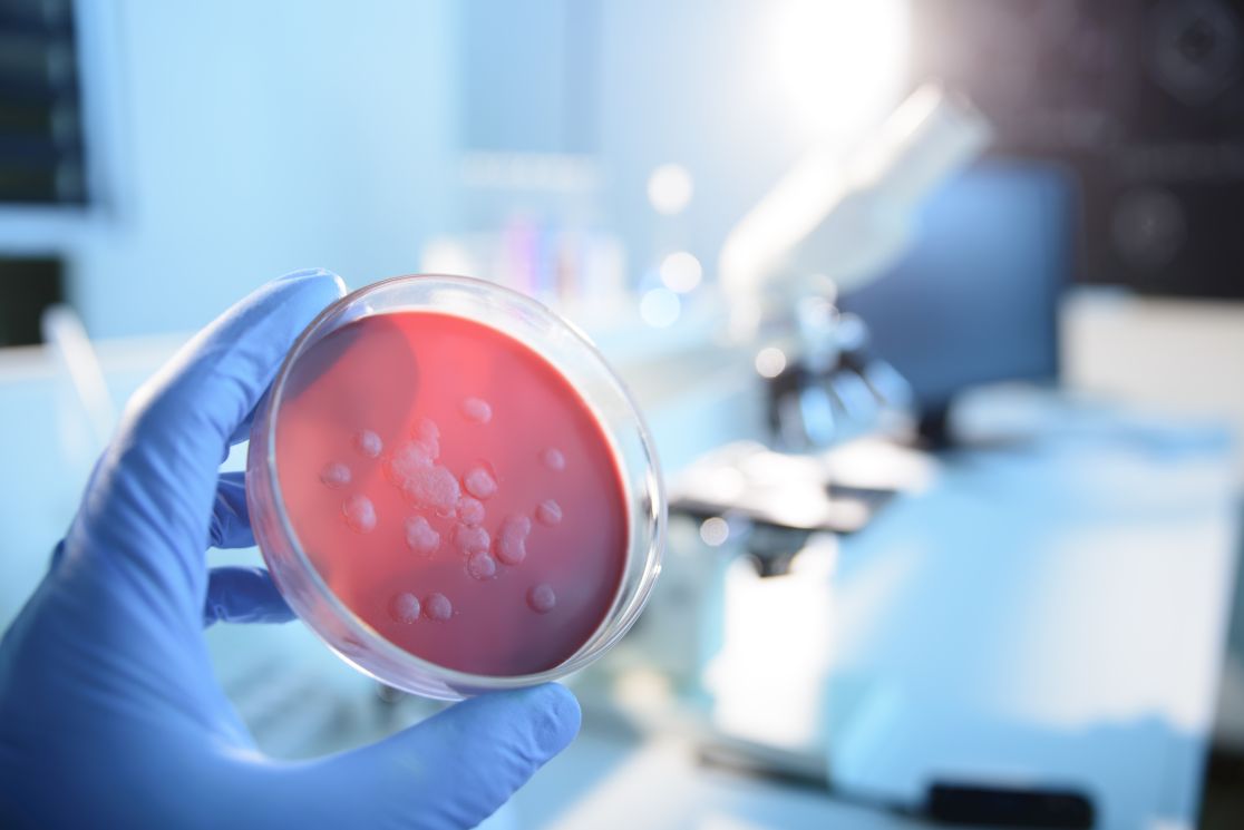 Petri dish