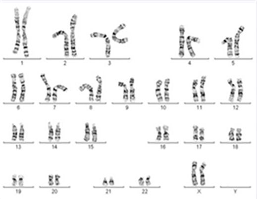 Abbildung weiblicher Chromosomensatz