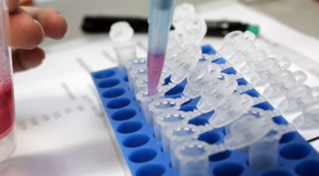 Pipette im Labor