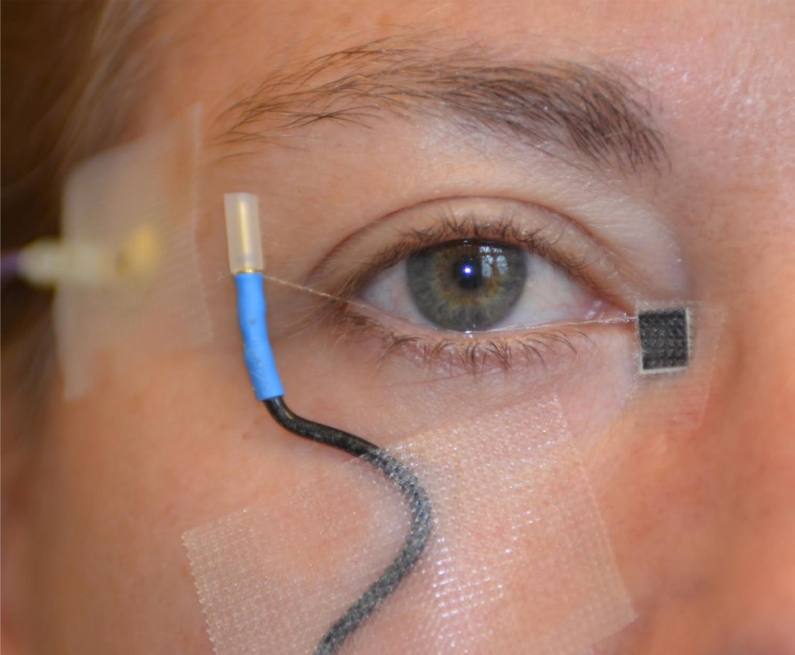 Behandlung mit Elektrostimulation am Auge