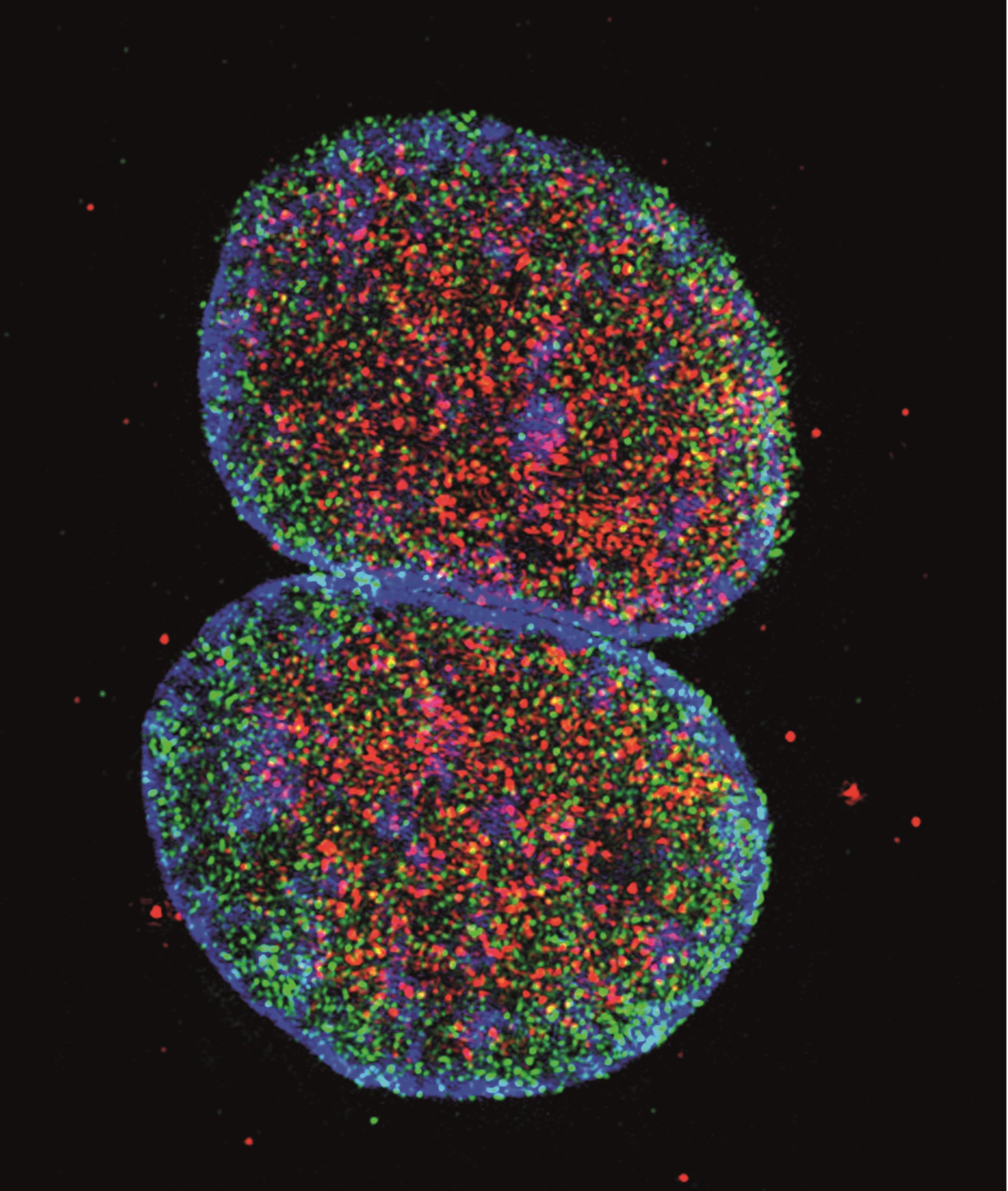 In menschlichen Immunzellen wurde die DNA im Zellkern (blau), sowie Virusproteine (grün) und die phosphorylierte, also inaktivierte Form von SAMHD1 (rot) angefärbt und mikroskopisch untersucht. (Urheber: Ramona Businger und Michael Schindler, Universitätsklinikum Tübingen).