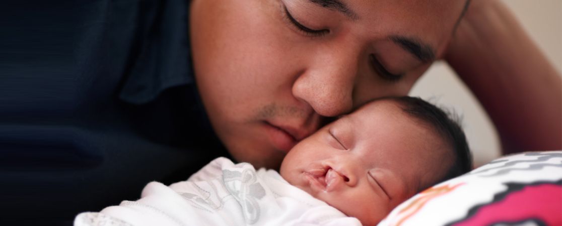Vater und Baby mit einer Lippen-Kiefer-Gaumenspalte