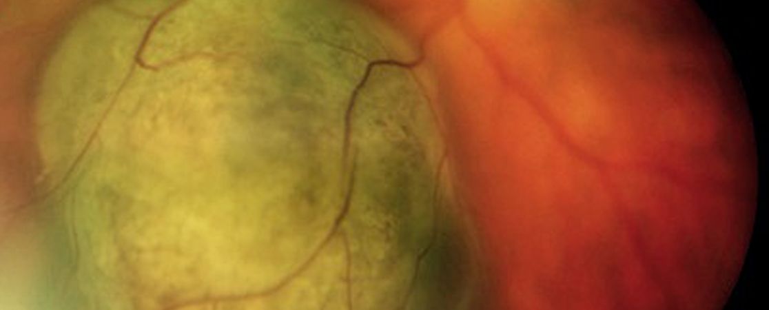 Auge Adern