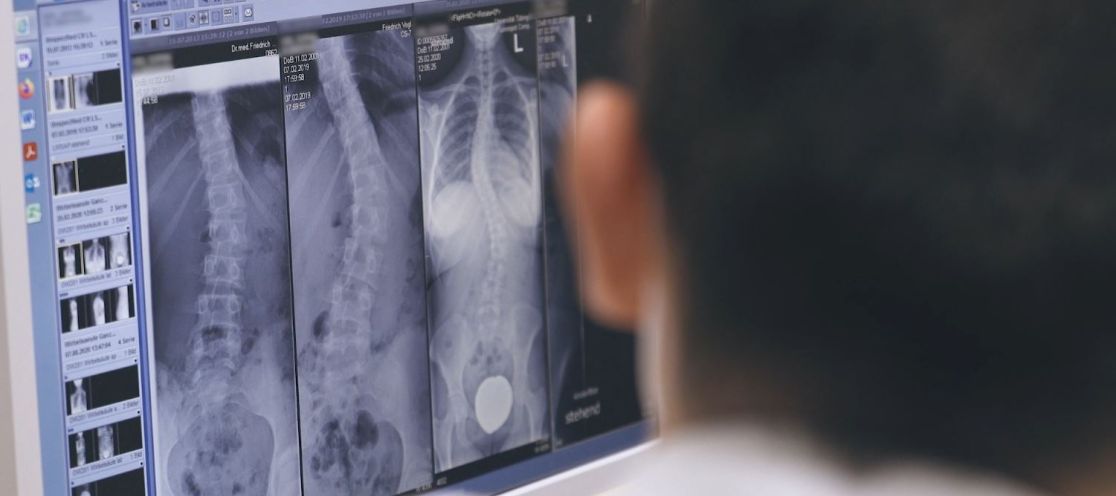 Arzt betrachtet Röntgenbild einer Skoliose