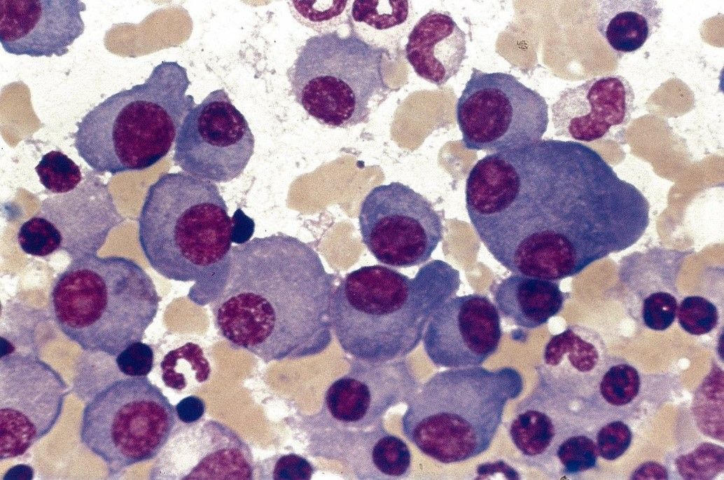 Wissenschaftliche Abbildung: Histologisches Bild der Plasmazellen