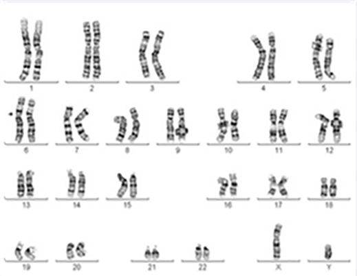 Abbildung männlicher Chromosomensatz