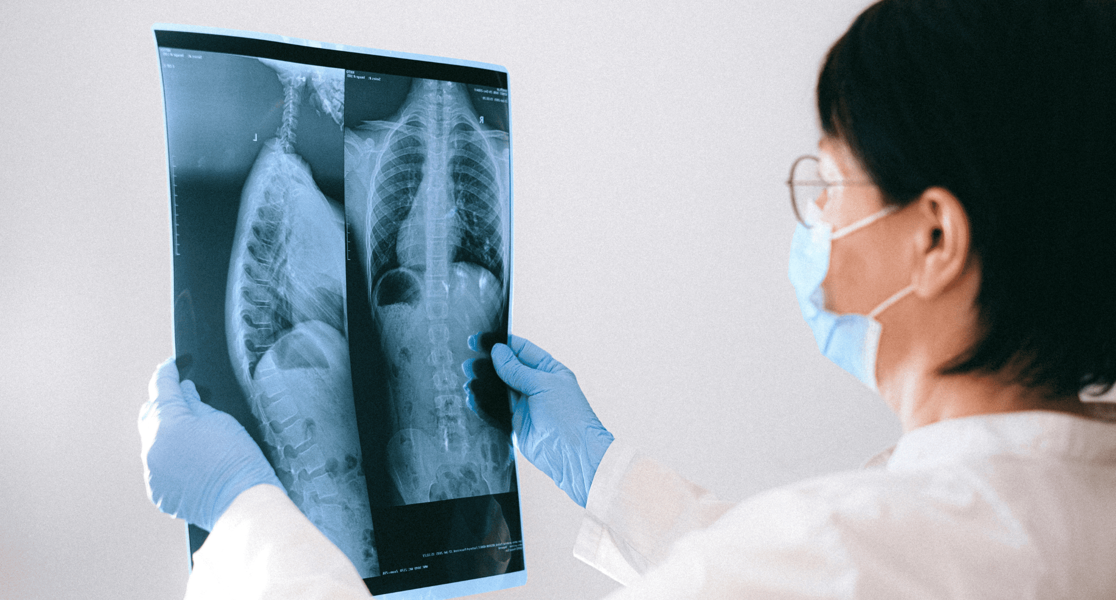 Was Knochenmetastasen für Betroffene bedeuten
