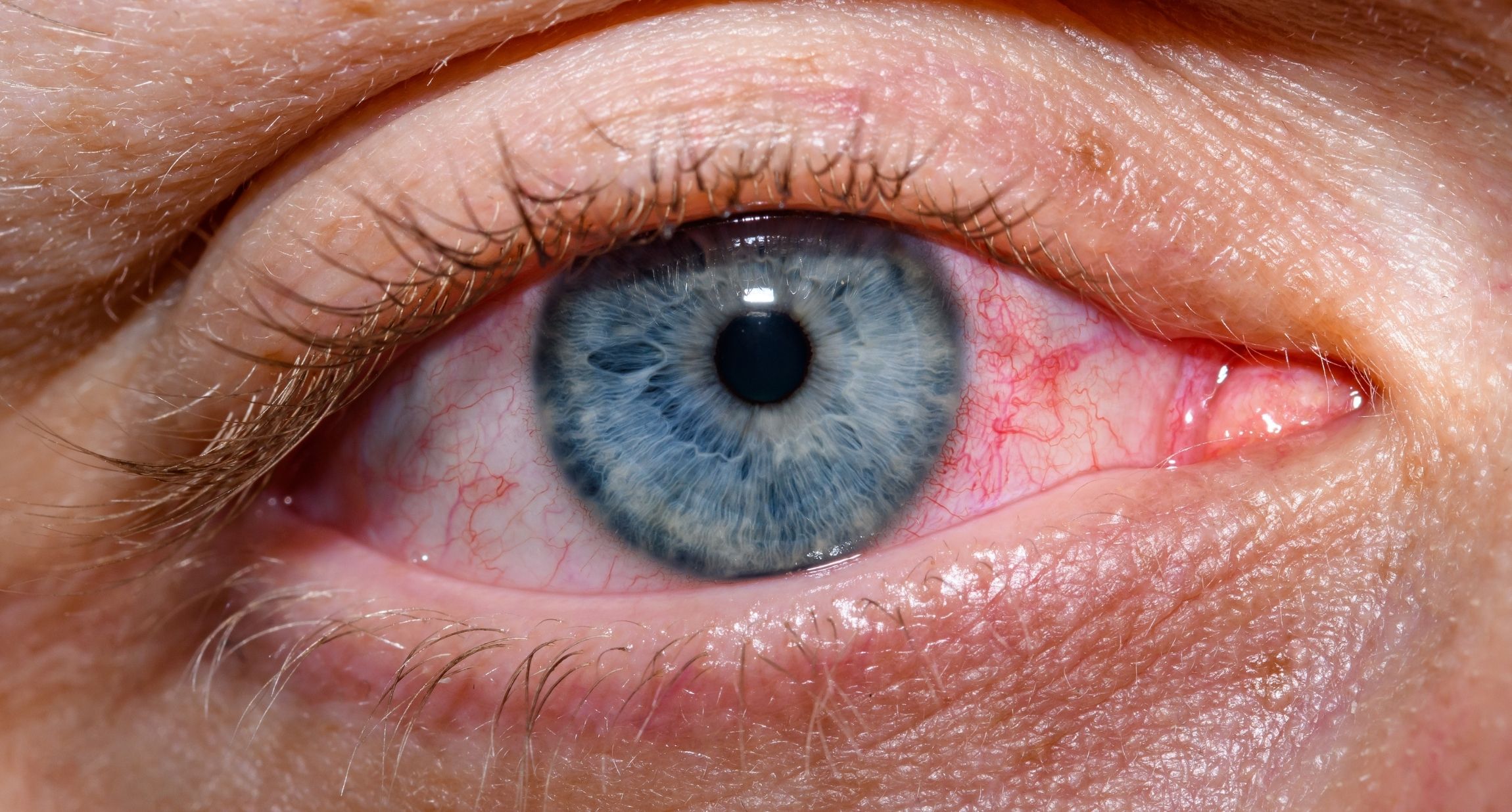 Was hilft gegen trockene Augen?