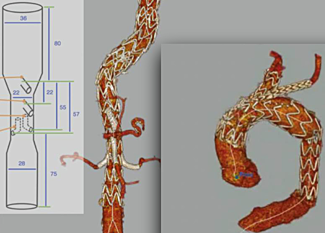 Symposium - Gefäßzentrum