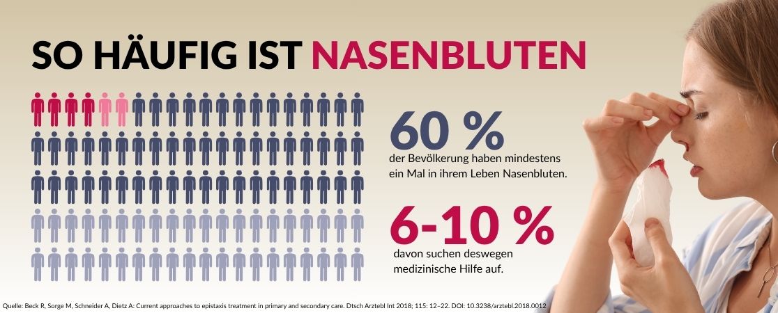 Grafik, die Häufigkeit von Nasenbluten zeigt. 60 % der Bevölkerung haben mindestens ein Mal in ihrem Leben Nasenbluten. 6-10 % davon suchen deswegen medizinische Hilfe auf.